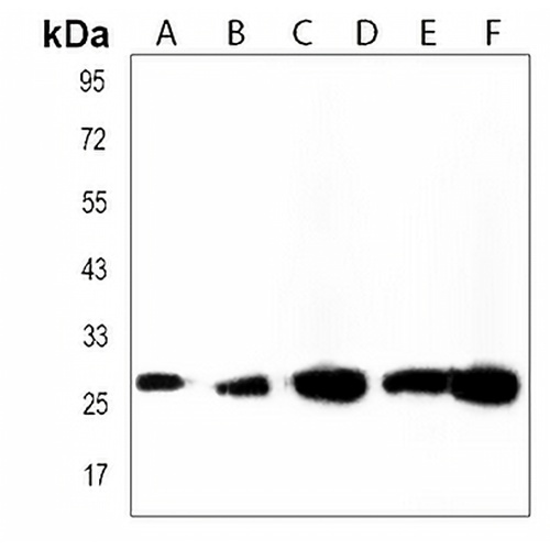 UQCRFS1P1 Rabbit Polyclonal Antibody