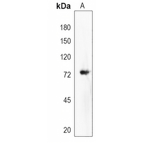 DVL1P1 Rabbit Polyclonal Antibody