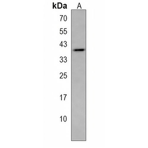 EI24 Rabbit Polyclonal Antibody