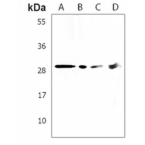 ACBD4 Rabbit Polyclonal Antibody