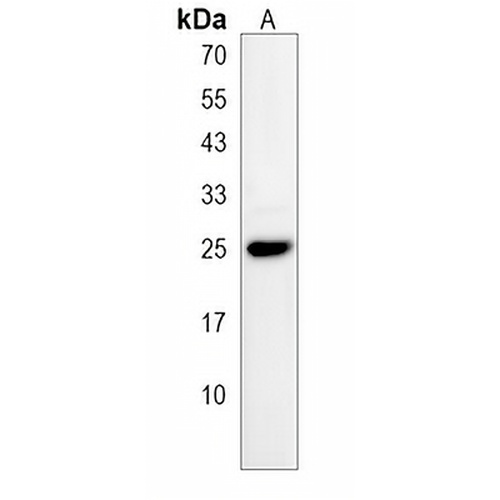 TMED4 Rabbit Polyclonal Antibody