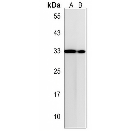 TMEM158 Rabbit Polyclonal Antibody
