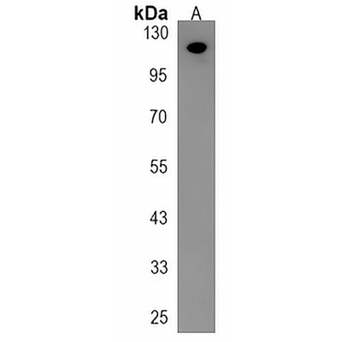 PTPN12 Rabbit Polyclonal Antibody