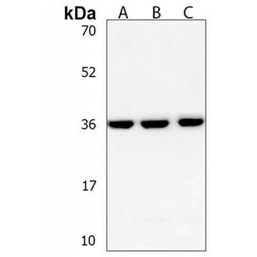 HUG1 Rabbit Polyclonal Antibody