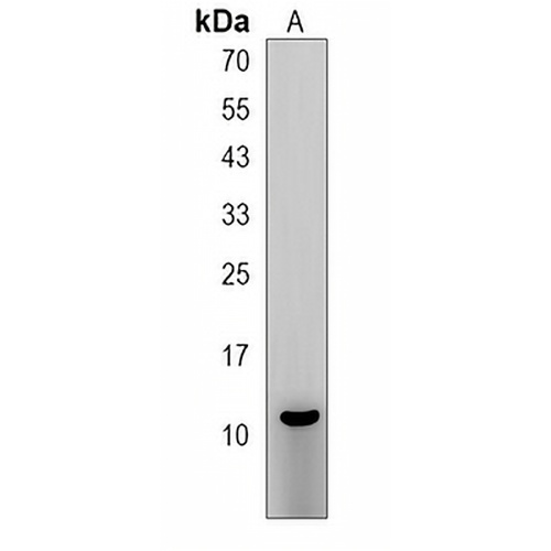 RIG Rabbit Polyclonal Antibody