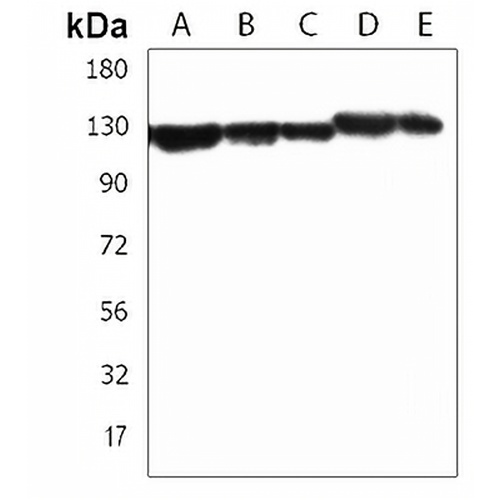 TACC3 Rabbit Polyclonal Antibody