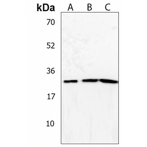 NT5M Rabbit Polyclonal Antibody