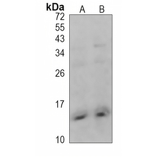 CXCL4 Rabbit Polyclonal Antibody