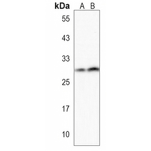 PPAPDC1B Rabbit Polyclonal Antibody