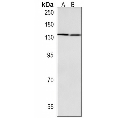 MTUS1 Rabbit Polyclonal Antibody
