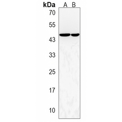 CERS2 Rabbit Polyclonal Antibody