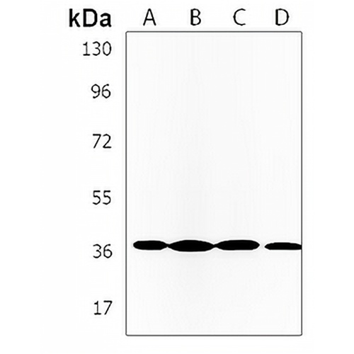 GBGT1 Rabbit Polyclonal Antibody