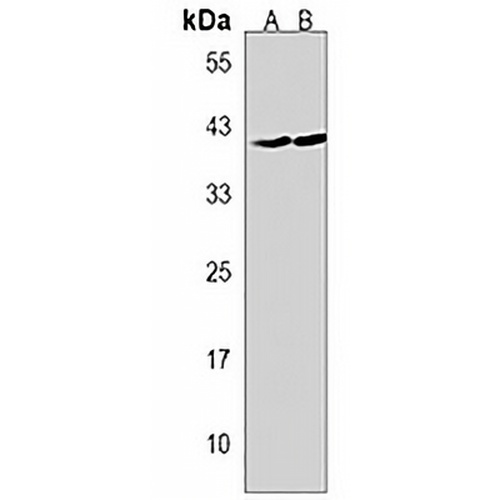 GMPPB Rabbit Polyclonal Antibody