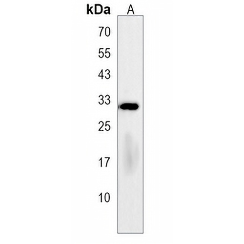 LHPP Rabbit Polyclonal Antibody