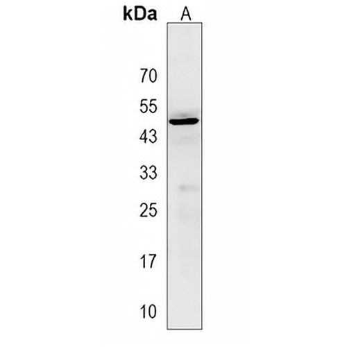 ACP6 Rabbit Polyclonal Antibody