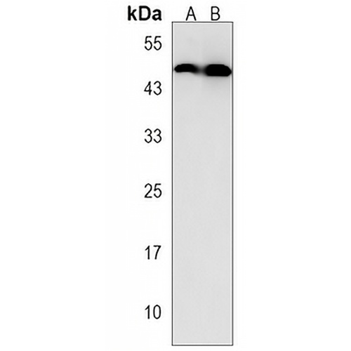 ACP6 Rabbit Polyclonal Antibody