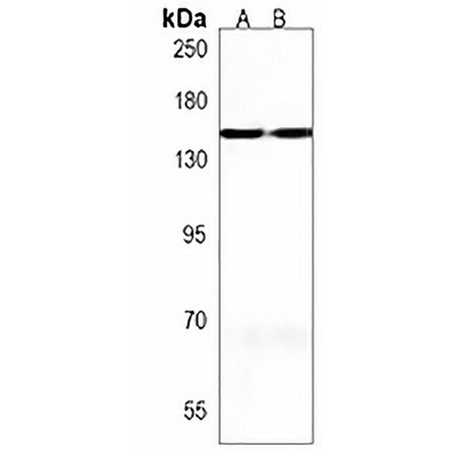 MTUS2 Rabbit Polyclonal Antibody