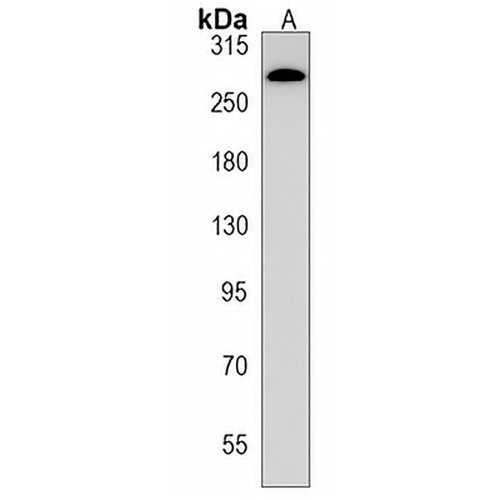 JMJD1C Rabbit Polyclonal Antibody