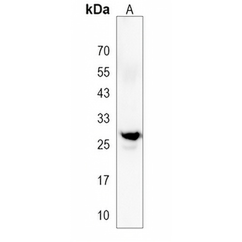 PRTN3 Rabbit Polyclonal Antibody