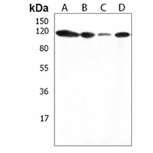 THSD1 Rabbit Polyclonal Antibody
