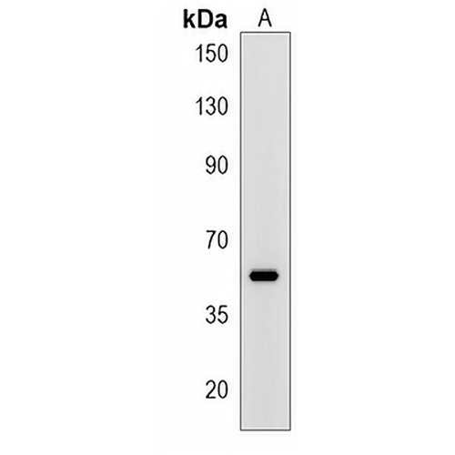 ERVK-21 Rabbit Polyclonal Antibody