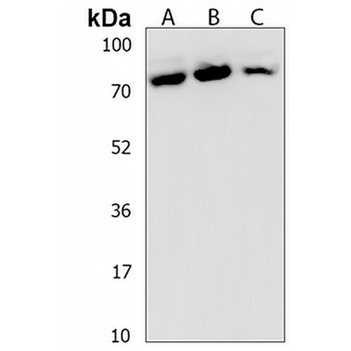 SPTLC3 Rabbit Polyclonal Antibody