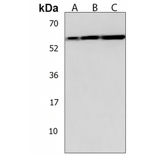 HEXDC Rabbit Polyclonal Antibody