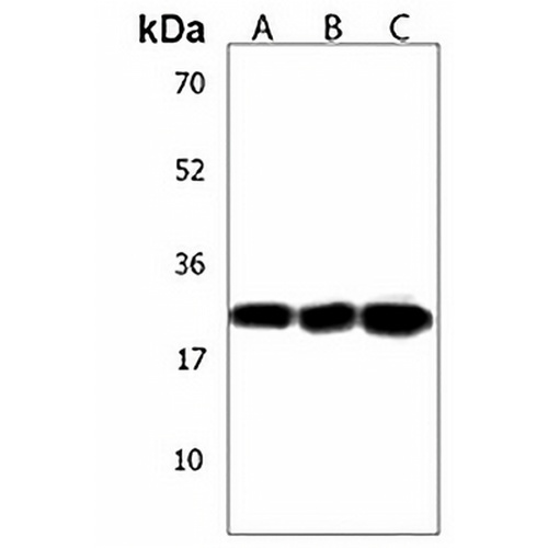 NAA40 Rabbit Polyclonal Antibody