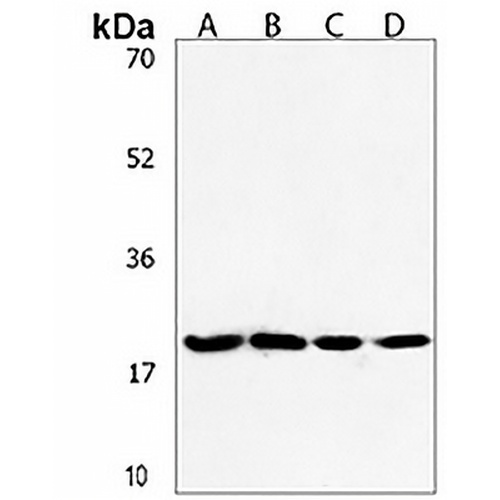 ANAPC11 Rabbit Polyclonal Antibody