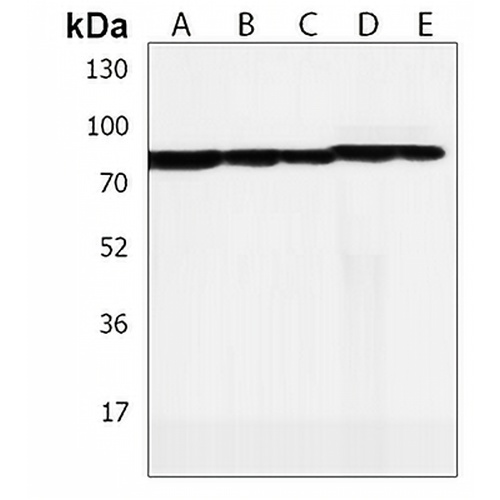 LRCH4 Rabbit Polyclonal Antibody