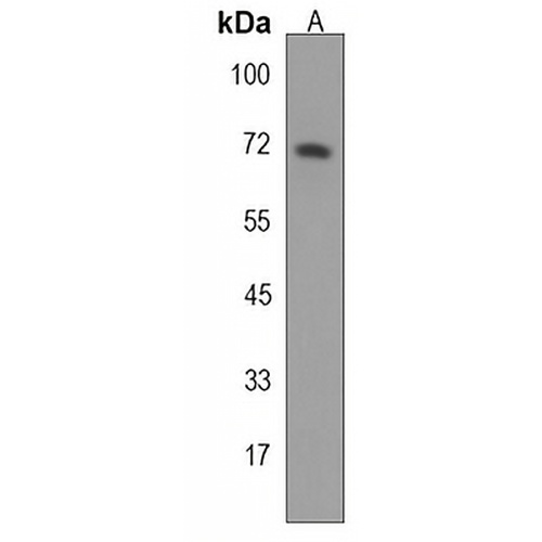 STT3A Rabbit Polyclonal Antibody