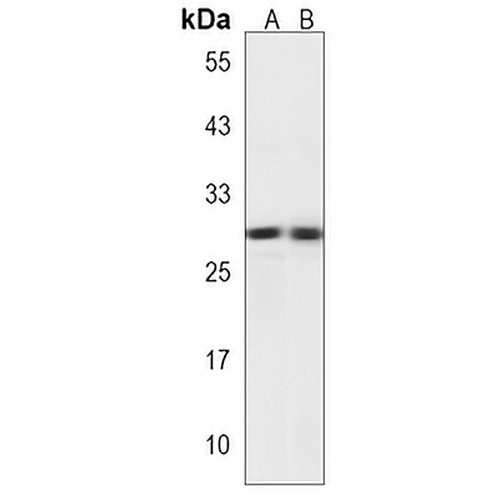 PPP1R3E Rabbit Polyclonal Antibody