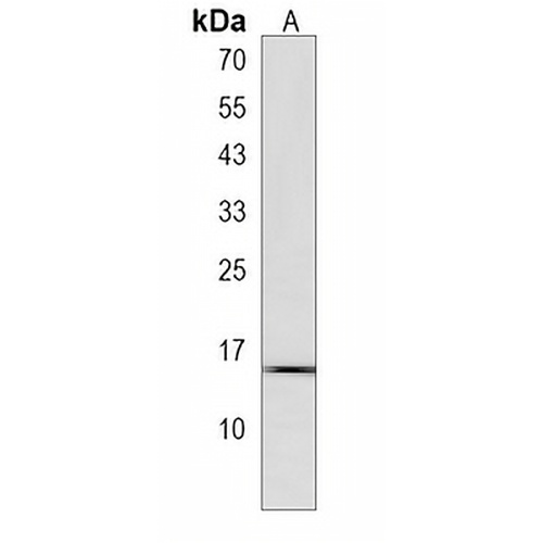 SYNJ2BP Rabbit Polyclonal Antibody