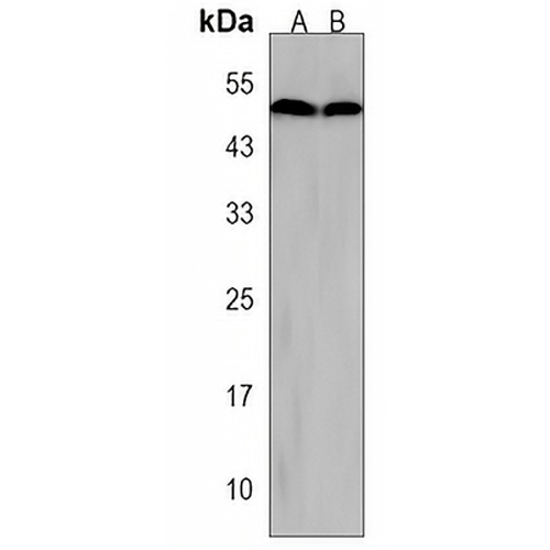 CTB Rabbit Polyclonal Antibody