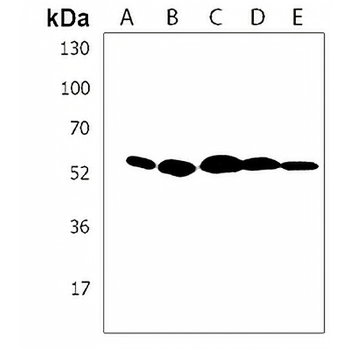 IRX4 Rabbit Polyclonal Antibody