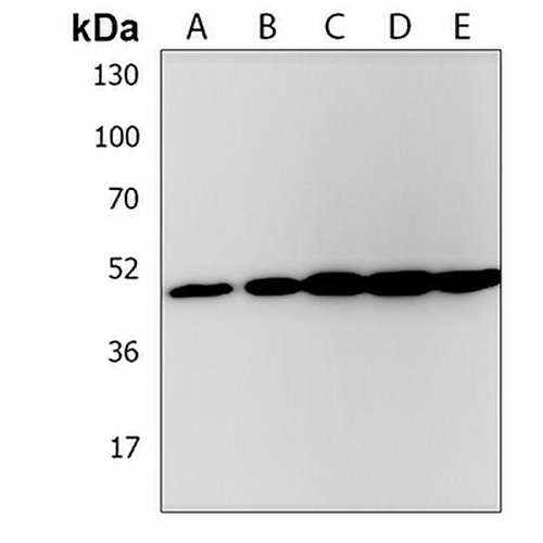 EEF1A1P5 Rabbit Polyclonal Antibody