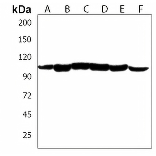 PGAP1 Rabbit Polyclonal Antibody
