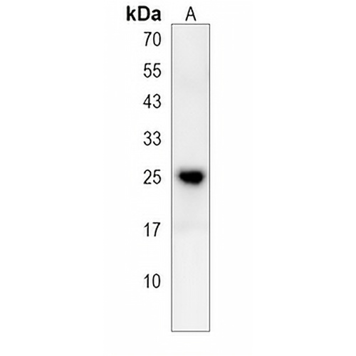 GSTA5 Rabbit Polyclonal Antibody