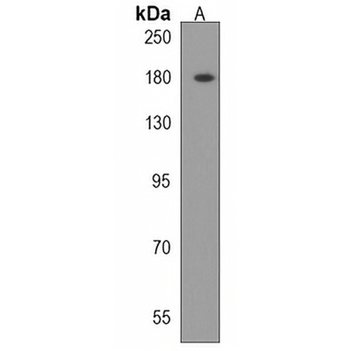 ADAMTS20 Rabbit Polyclonal Antibody
