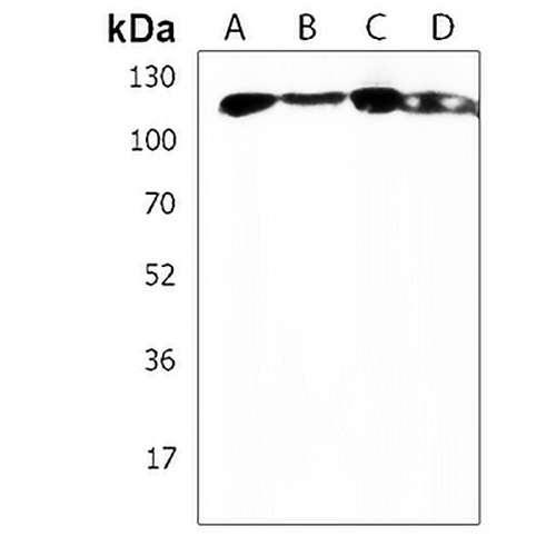 INTS3 Rabbit Polyclonal Antibody