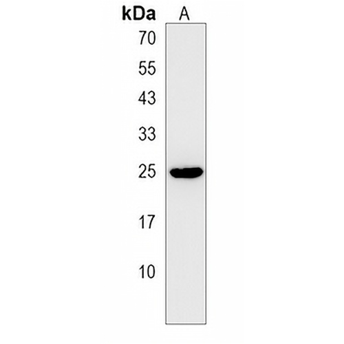 MIF4GD Rabbit Polyclonal Antibody