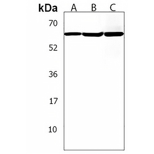 GGT3P Rabbit Polyclonal Antibody