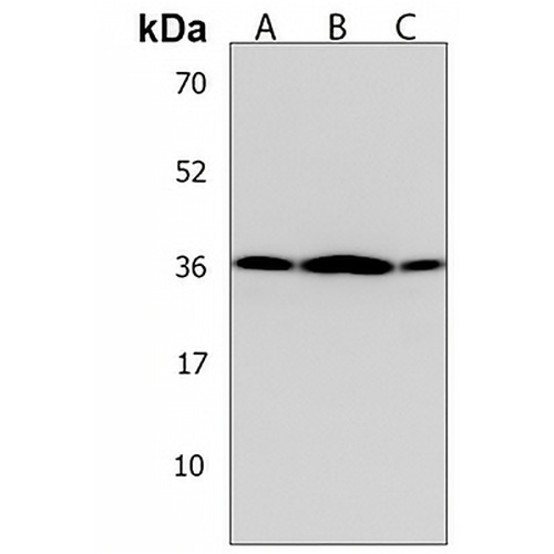 OR5V1 Rabbit Polyclonal Antibody