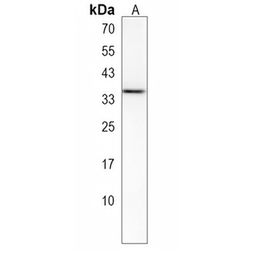 OR1B1 Rabbit Polyclonal Antibody