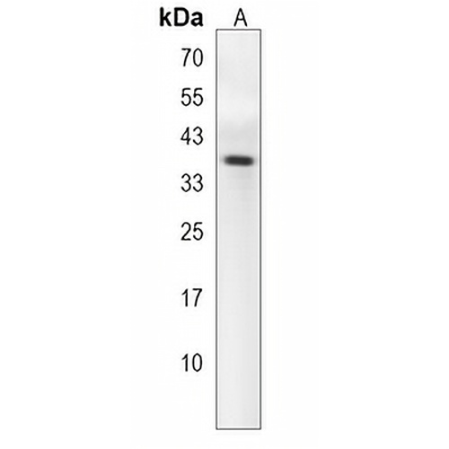TAS2R5 Rabbit Polyclonal Antibody