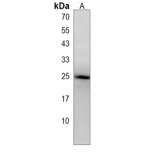 ARL2 Rabbit Polyclonal Antibody
