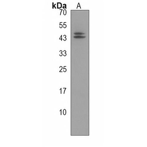 ART3 Rabbit Polyclonal Antibody