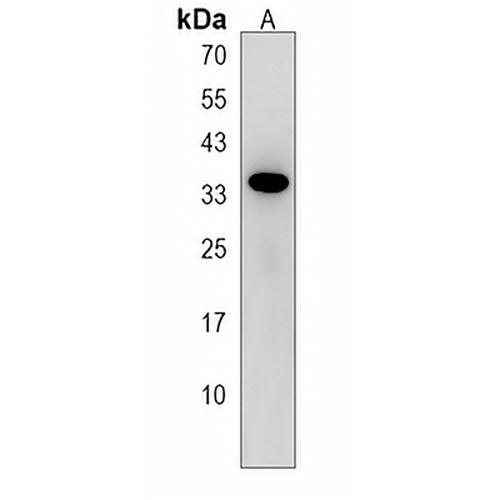 SULT4A1 Rabbit Polyclonal Antibody