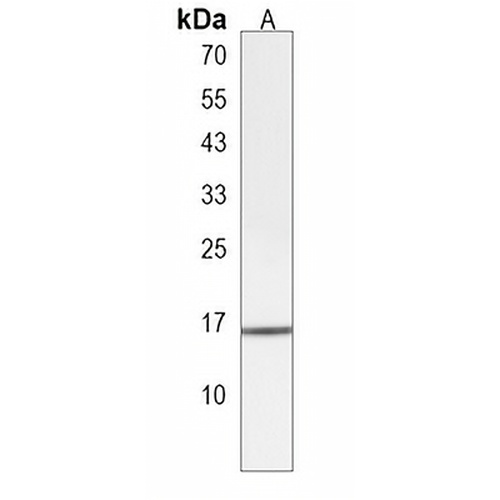 DCTPP1 Rabbit Polyclonal Antibody