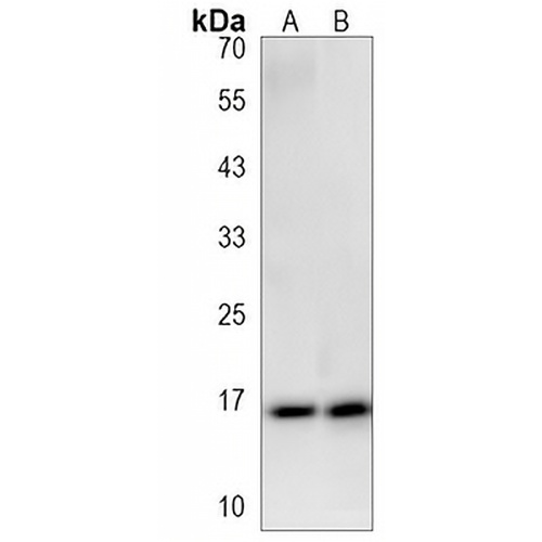 SNRPD1 Rabbit Polyclonal Antibody